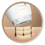 Epilator IPL Remington i-Light Luxe IPL8500, 300.000 Pulsatii, Tehnologie ProPulse, Senzori inteligenti pentru tonul pie