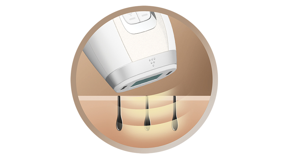 Epilator IPL Remington i-Light Luxe IPL8500, 300.000 Pulsatii, Tehnologie ProPulse - Epilatoare Epilator IPL Remington i-Light Luxe IPL8500, 300.000 Pulsatii, Tehnologie ProPulse, Senzori inteligenti pentru tonul pie